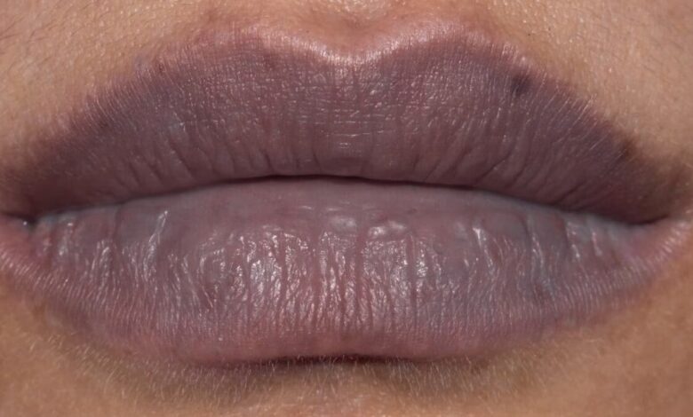Tips to remove dark lips
