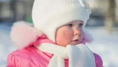 Protect your child from these common skin problems in winter, know the preventive measures.