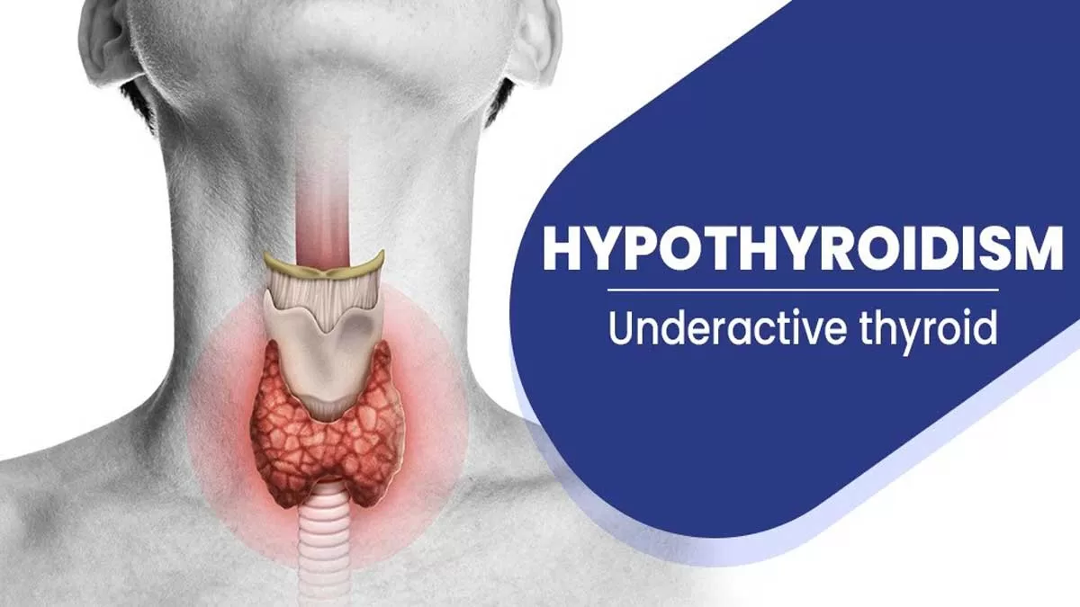 5 Common Thyroid Disorders