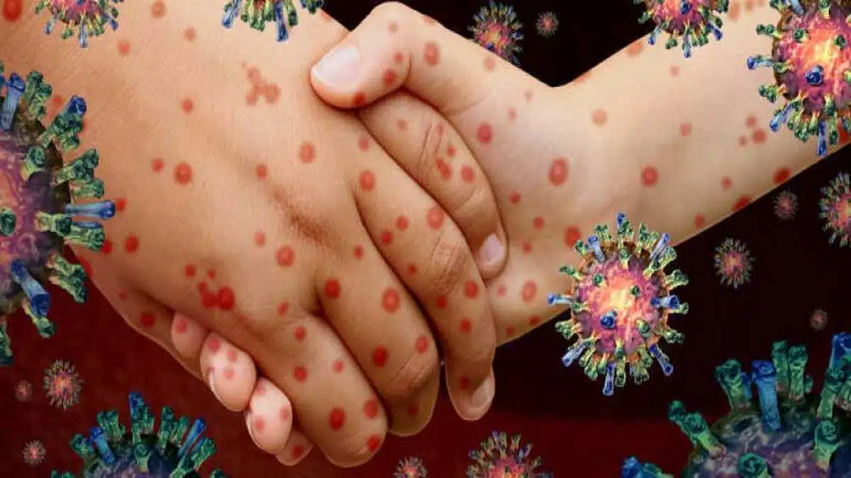 6 Key Facts About Infectious Diseases