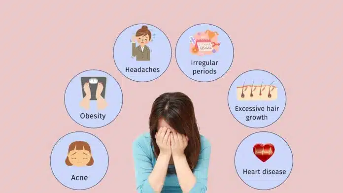 8 Effects of PCOD on Women's Health