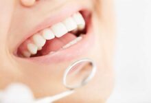 8 Foods to Eat After Wisdom Teeth Surgery