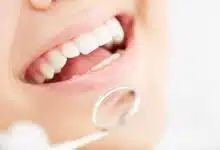8 Foods to Eat After Wisdom Teeth Surgery