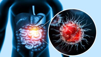 You must include anti-cancer spices in your diet.