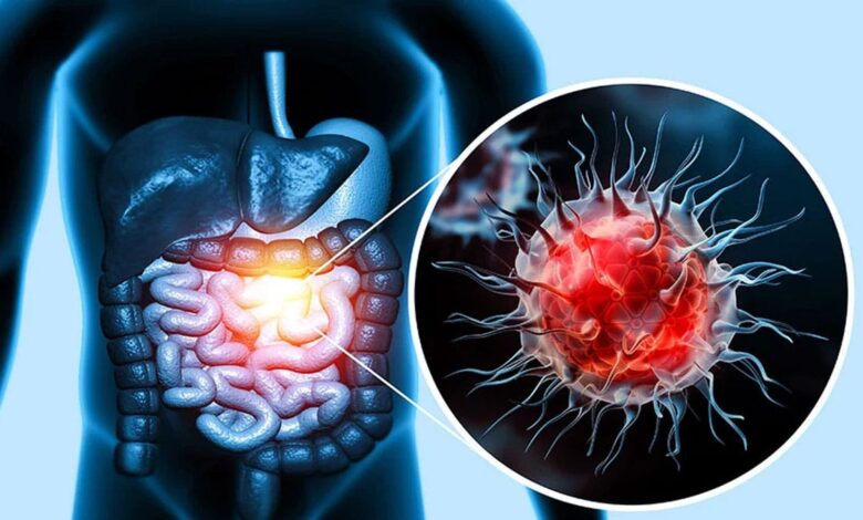 You must include anti-cancer spices in your diet.