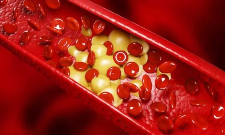 Cholesterol will be reduced in winter by following these 5 measures