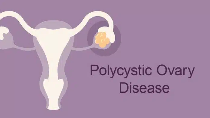 Effects of PCOD on Women's Health