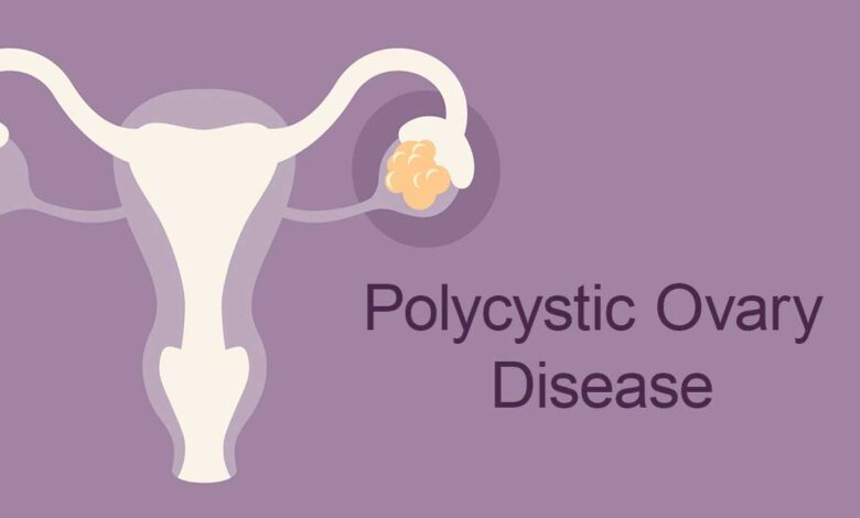 Effects of PCOD on Women's Health