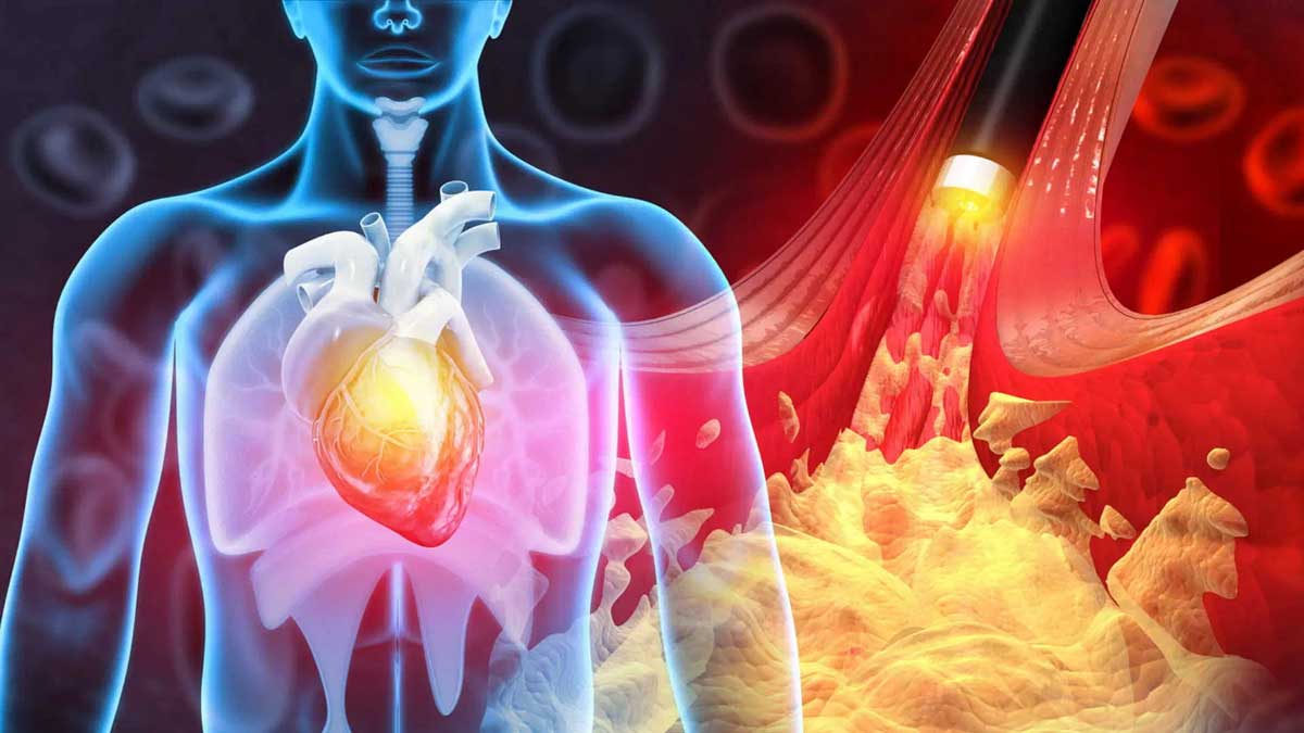 The role of genetics in heart attack risk