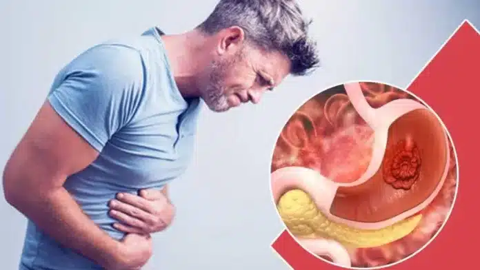 These 5 symptoms appear in the body when there is a tumor in the stomach