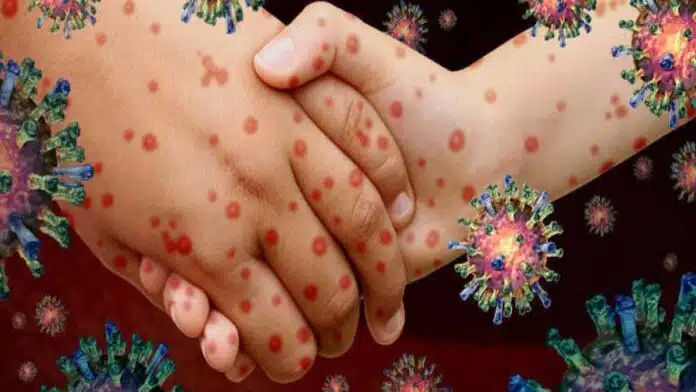 What are the most common infectious diseases