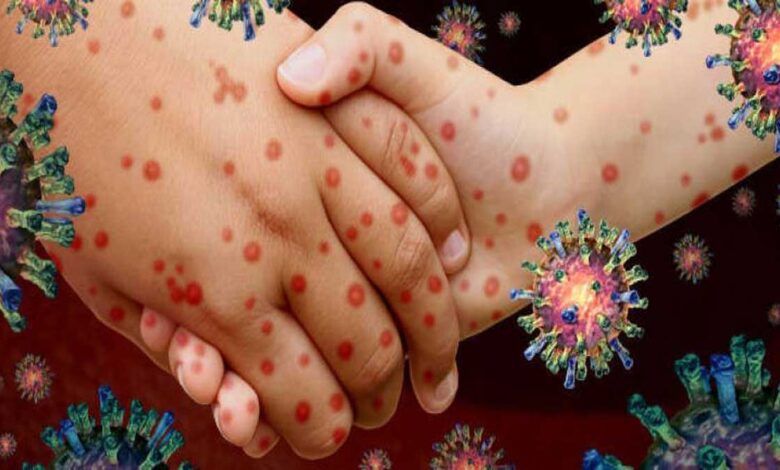 What are the most common infectious diseases