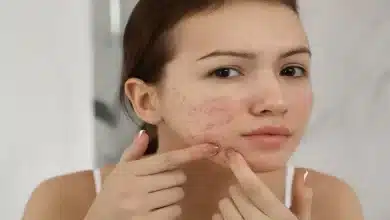 Does your daily routine cause acne for you? Here's how to stop it