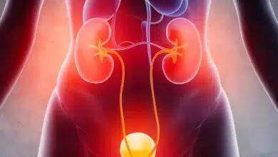 Frequent UTIs? How chronic infections could be linked to your gut health, know details