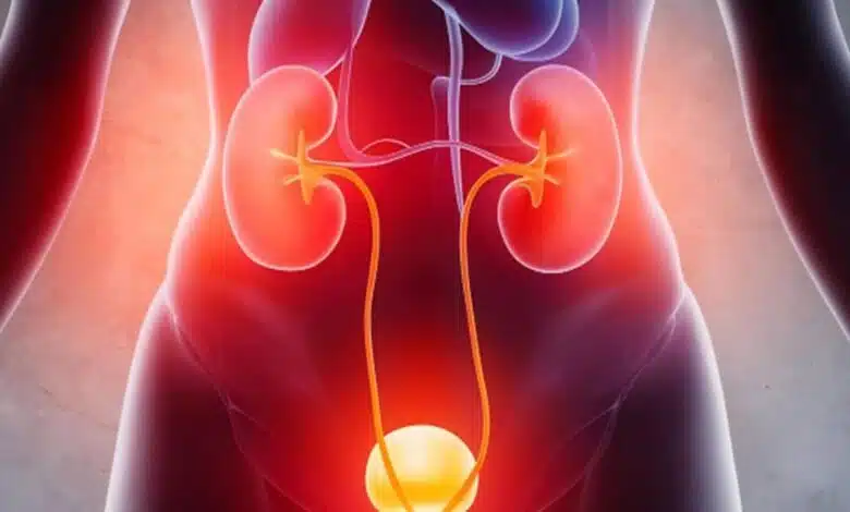 Frequent UTIs? How chronic infections could be linked to your gut health, know details