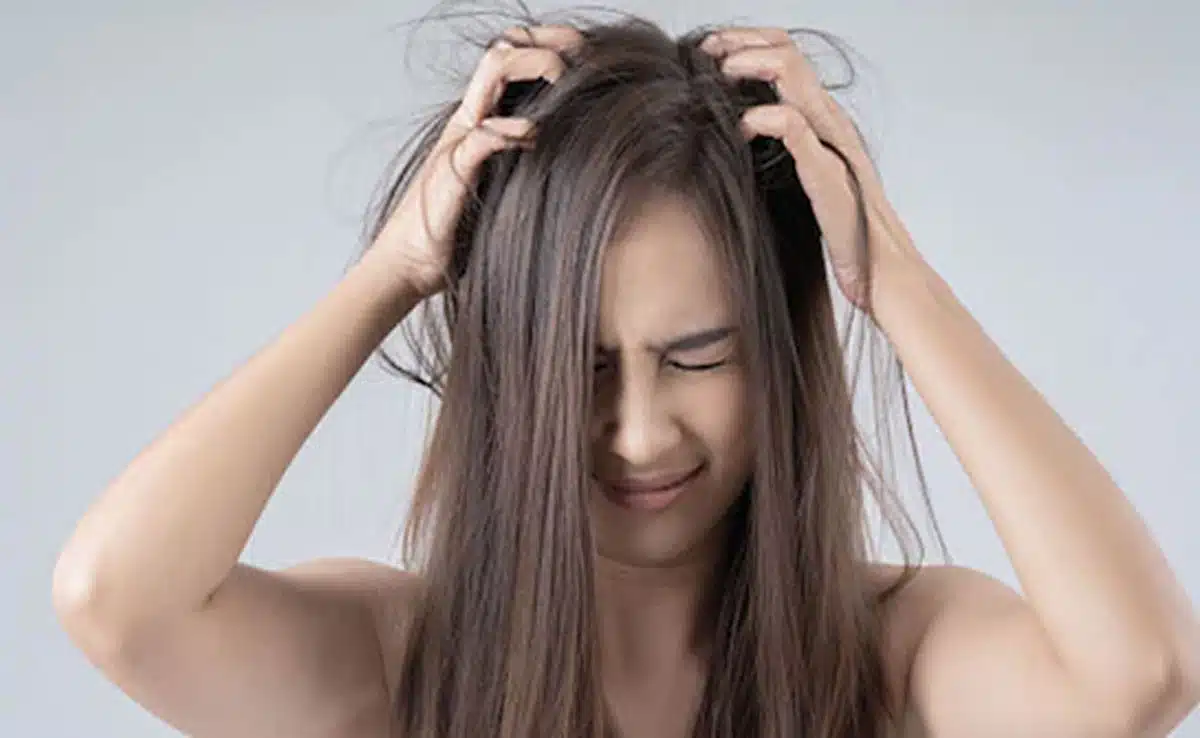 Applying curd on hair prevents these scalp problems, know its benefits and methods of use.