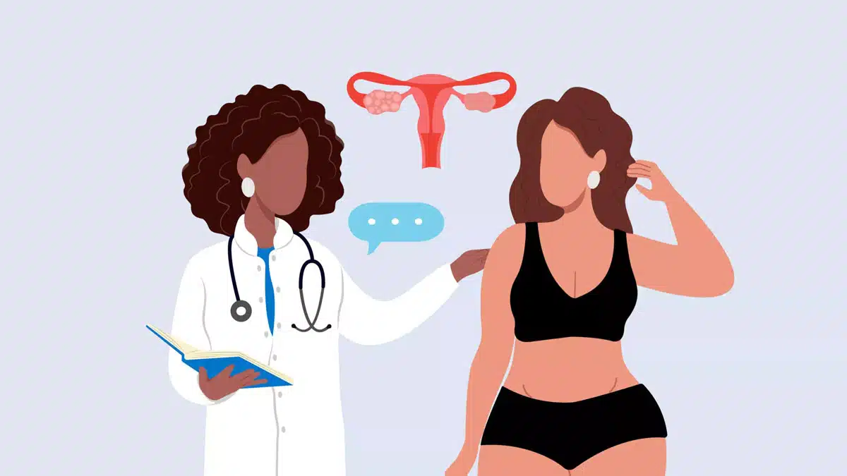 PCOS: Causes, Symptoms, Treatment and Management