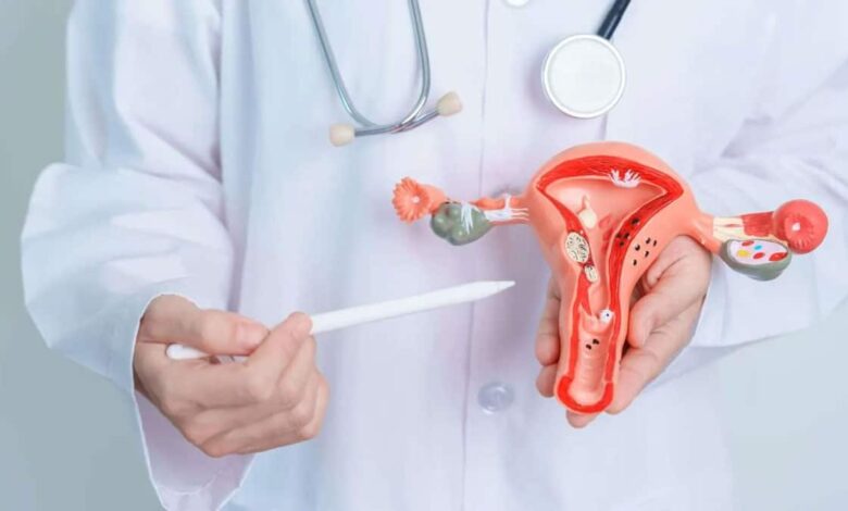 PCOS: Causes, Symptoms, Treatment and Management