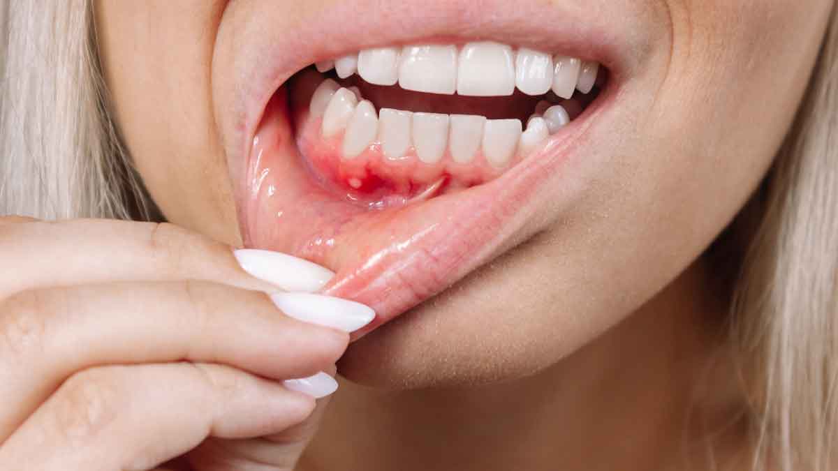 Easy and effective remedies for relief from toothache!