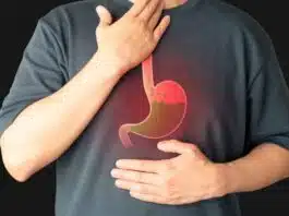 Frequent Acidity Try these simple diet changes!