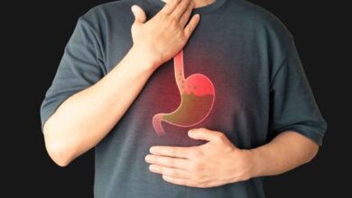 Frequent Acidity Try these simple diet changes!
