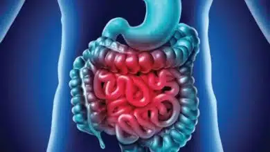 Are you suffering from inflammation in your intestines? Know the symptoms and what to eat to get relief