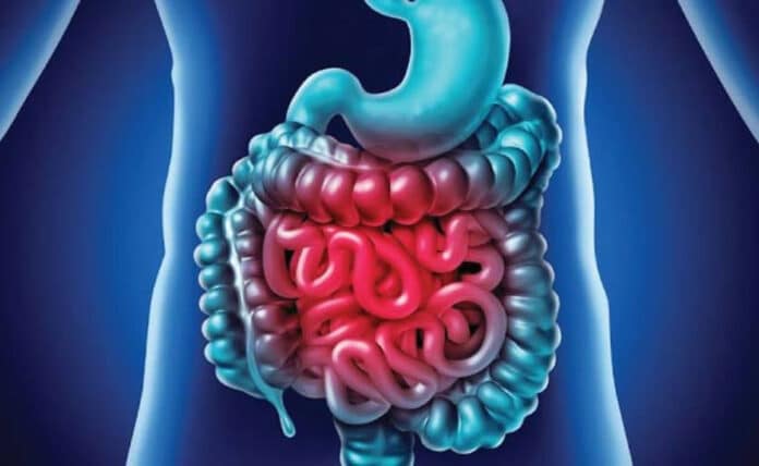 Are you suffering from inflammation in your intestines? Know the symptoms and what to eat to get relief