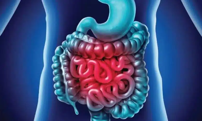 Are you suffering from inflammation in your intestines? Know the symptoms and what to eat to get relief