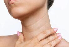 Want to prevent neck wrinkles? Follow these 5 daily tips before the age of 40