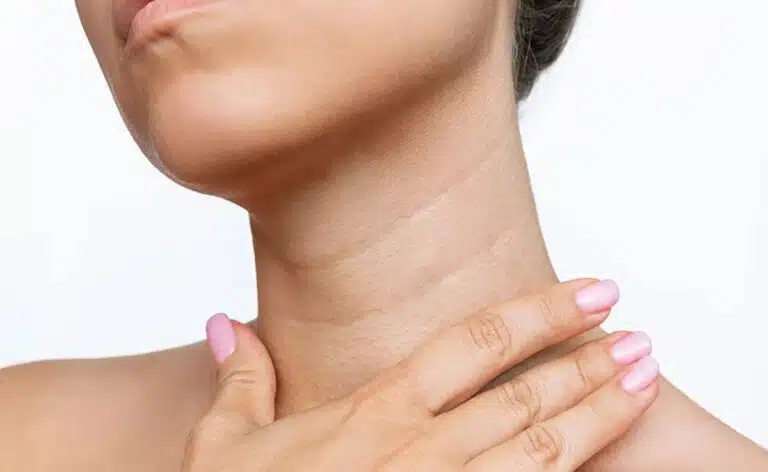 Neck की झुर्रियों को रोकना चाहते हैं? 40 की उम्र से पहले अपनाएं ये 5 दैनिक टिप्स