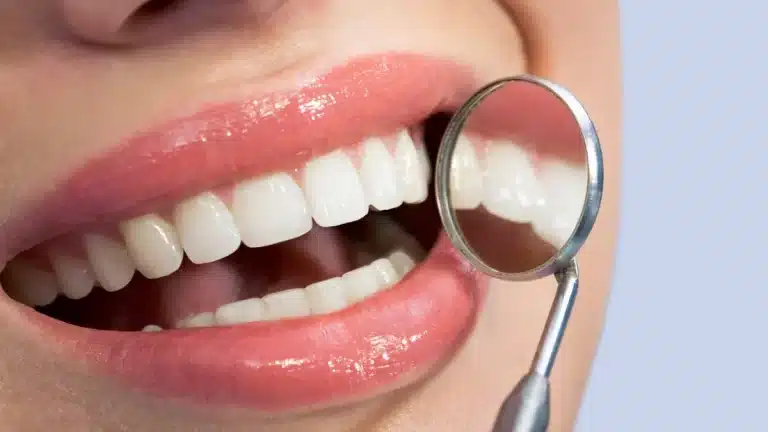 Teeth की सड़न या खतरा दिल तक पहुंचा?