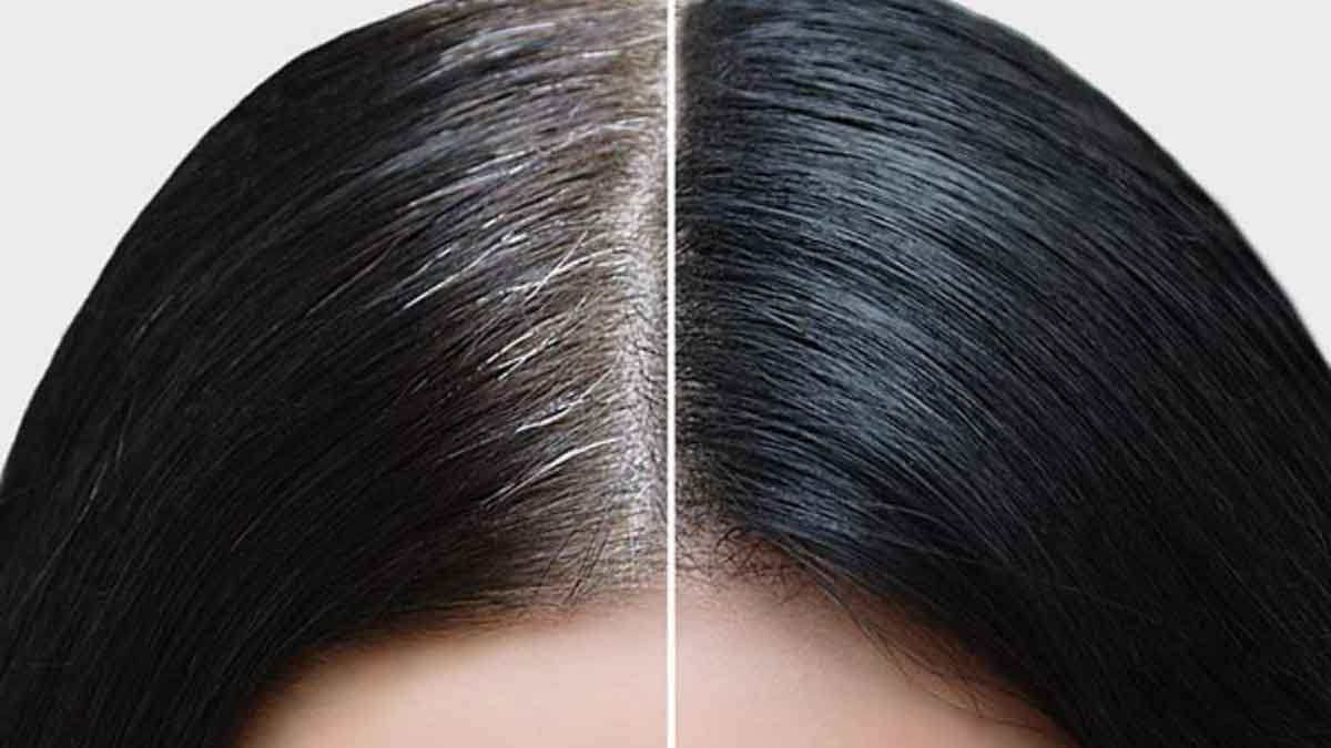 The ultimate cure for premature Gray Hair: Magic oil