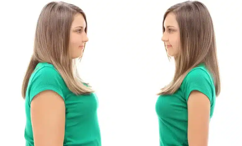 Weight Loss Tips Diet & Gym Alone Won’t Work!