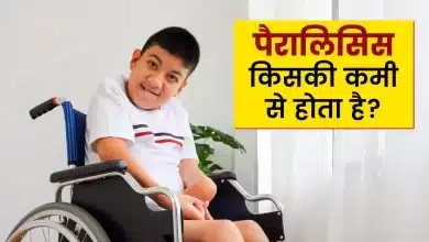 Which Vitamin deficiency causes paralysis?