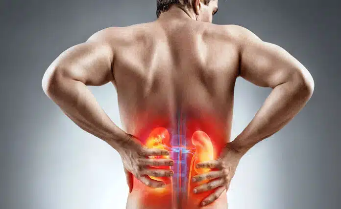 World Kidney Day 2025: Know the causes, symptoms, treatment and prevention of kidney stones