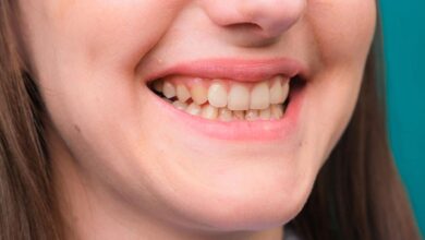 Embarrassed by yellow teeth? Then make them shine like pearls with these easy home remedies
