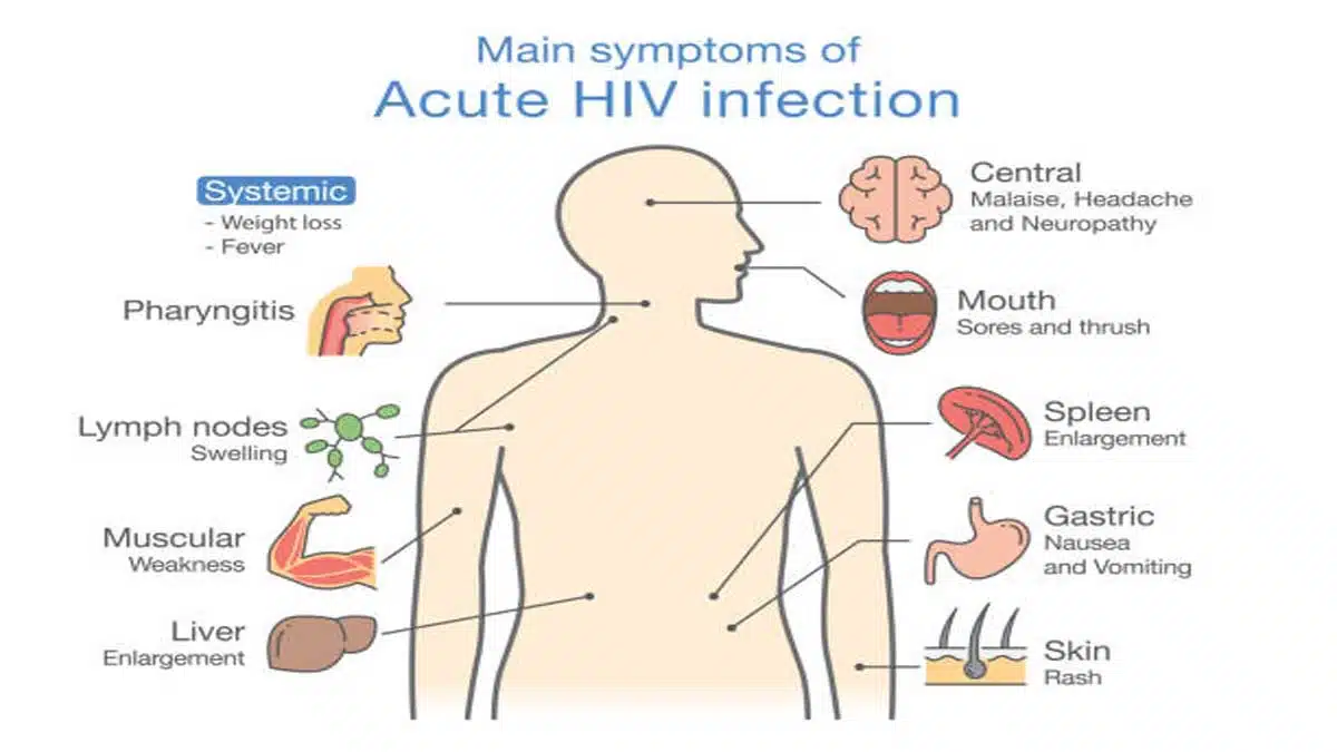 AIDS: Causes, Symptoms, Treatment