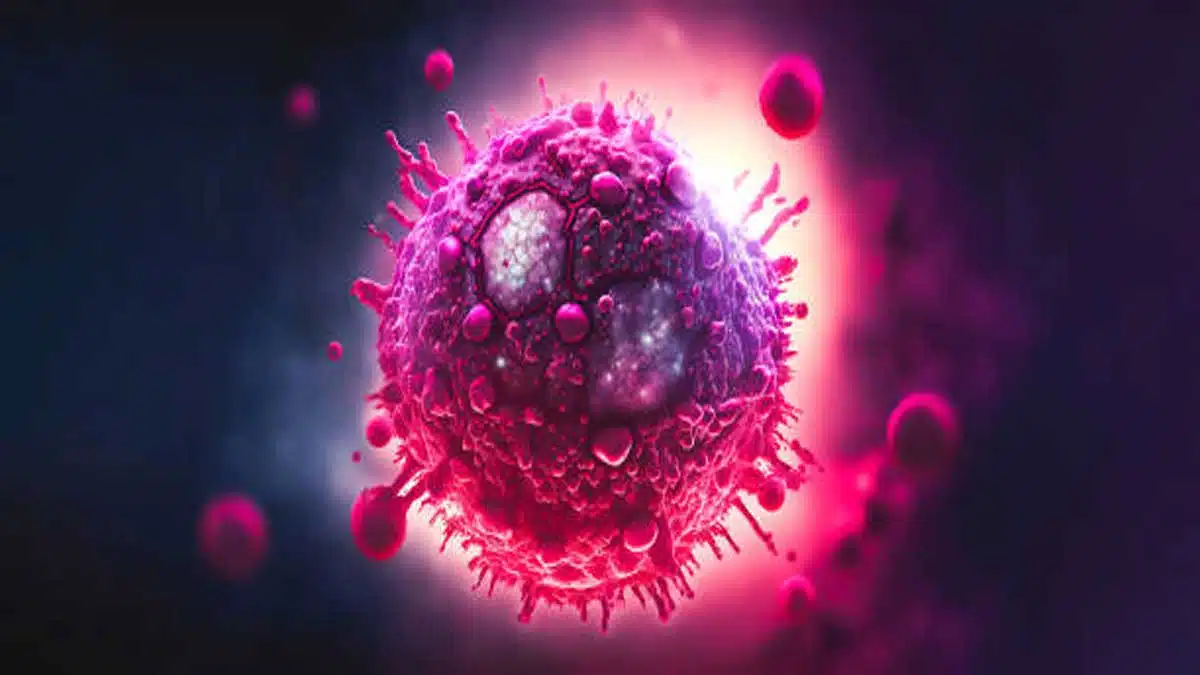 AIDS: Causes, Symptoms, Treatment