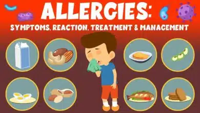 Allergy: Causes, Symptoms, Types, Diagnosis