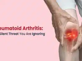 Arthritis: Causes, Symptoms, and Treatment