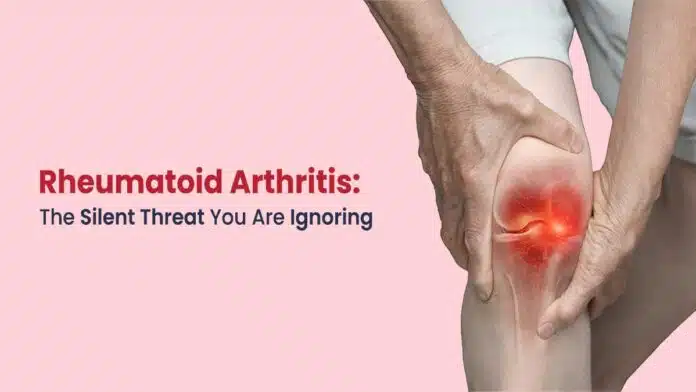 Arthritis: Causes, Symptoms, and Treatment