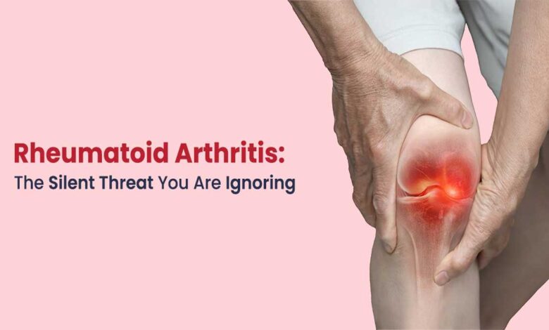 Arthritis: Causes, Symptoms, and Treatment