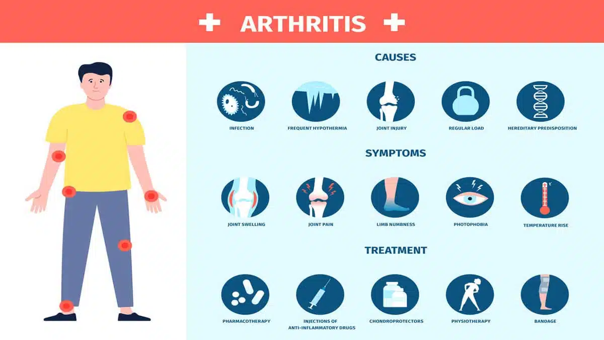 Arthritis: Causes, Symptoms, and Treatment
