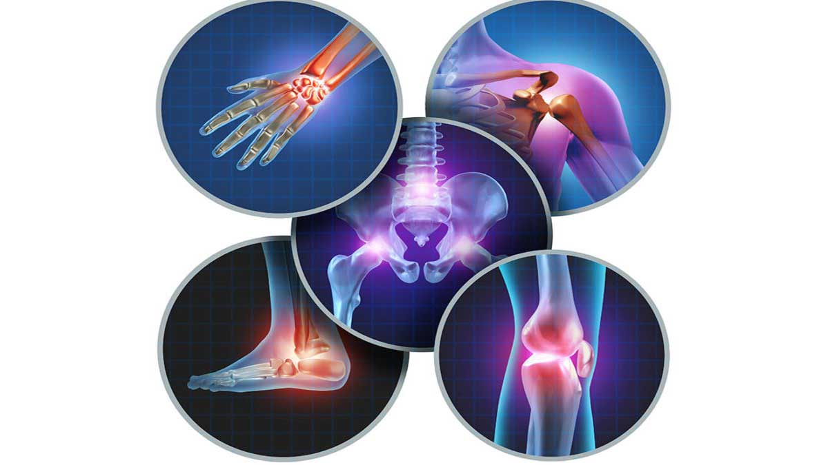 Arthritis: Causes, Symptoms, and Treatment