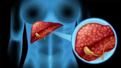 Beginning of Liver failure Know the 8 dangerous symptoms!
