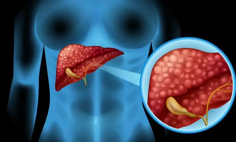 Beginning of Liver failure Know the 8 dangerous symptoms!