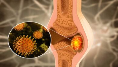 Bone Disorders: Causes, Symptoms, Types