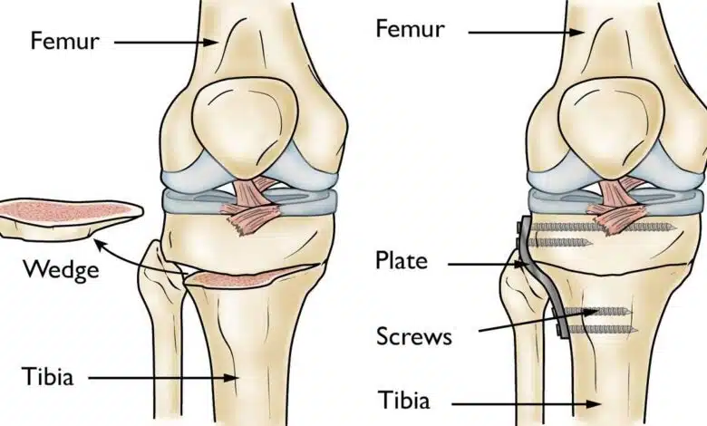 Bone Problems and Diseases: Causes
