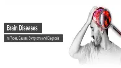 Brain Disorders: Causes, Symptoms, Diagnosis