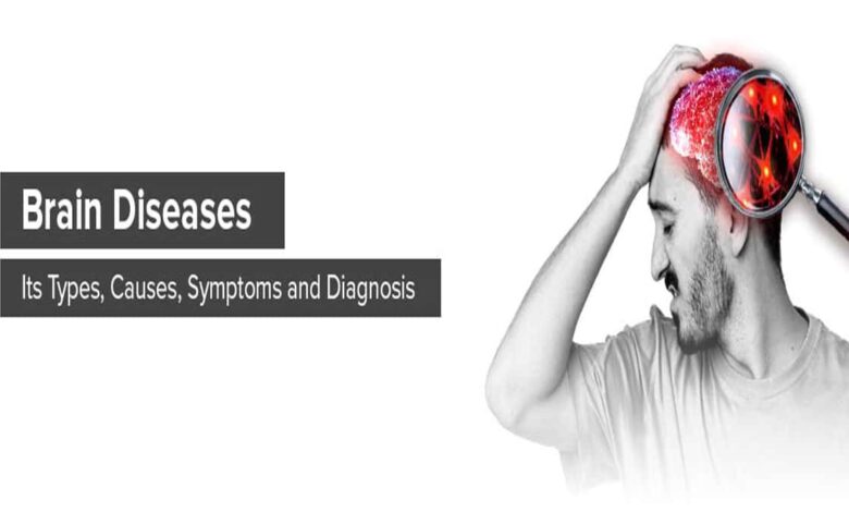 Brain Disorders: Causes, Symptoms, Diagnosis